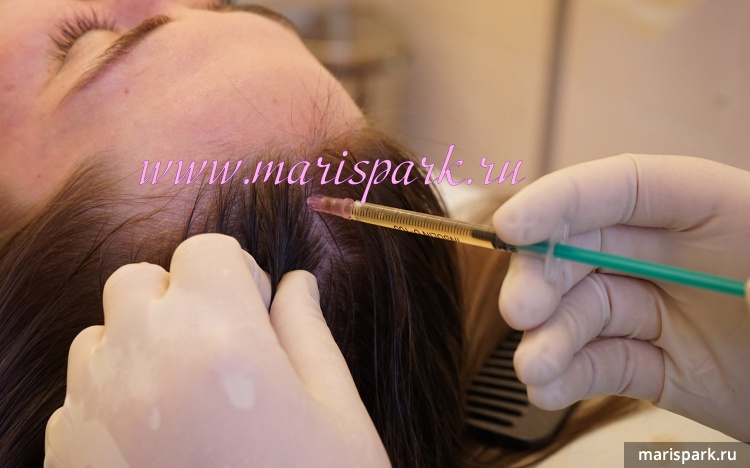 plasma treatment for hair